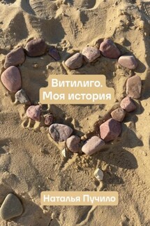 Витилиго. Моя история - Наталья Пучило