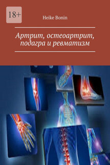 Артрит, остеоартрит, подагра и ревматизм - Heike Bonin
