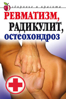 Ревматизм, радикулит, остеохондроз - Ю. Николаева