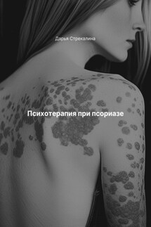 Психотерапия при псориазе - Дарья Стрекалина