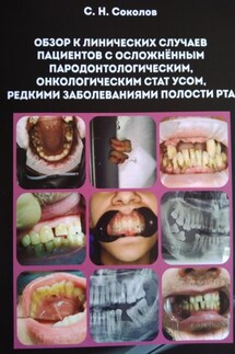 Обзор клинических случаев пациентов с осложнённым пародонтологическим, онкологическим статусом, редкими заболеваниями полости рта - Станислав Соколов